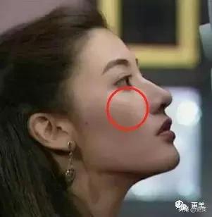 免费a级毛片无码专区:最新激光美容,免费A级毛片无码专区与最新激光美容技术的探索